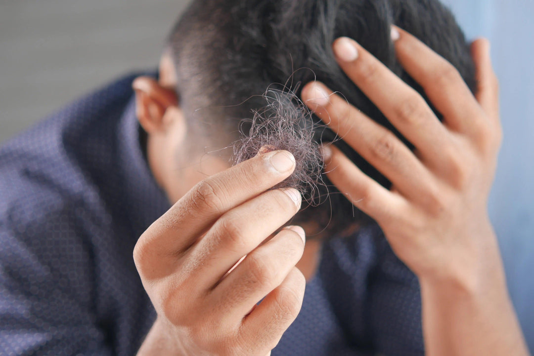 La Pérdida de Cabello: Causas Internas y Externas y Consejos para Cuidarlo de Forma Natural - Mar Amoli