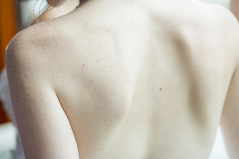Piel de Porcelana: Ingredientes Naturales y Consejos para Aclarar Tu Piel - Mar Amoli